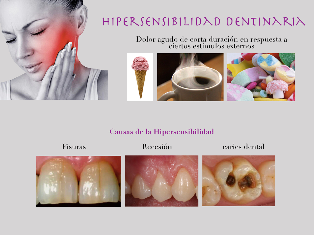 La sensibilidad dental o hipersensibilidad