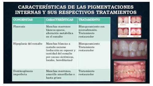 Hipoplasia del esmalte · Dentclinic · Mataró