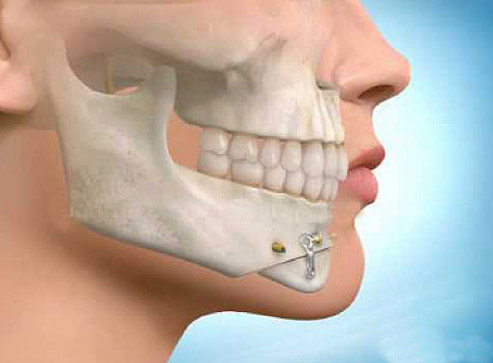 Cirugía Bucal y Maxilofacial · DentClínic · Clínica Dental en Mataró