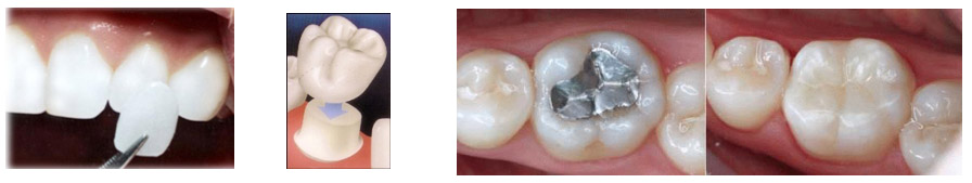Estética Dental · DentClínic · Clínica Dental Mataró