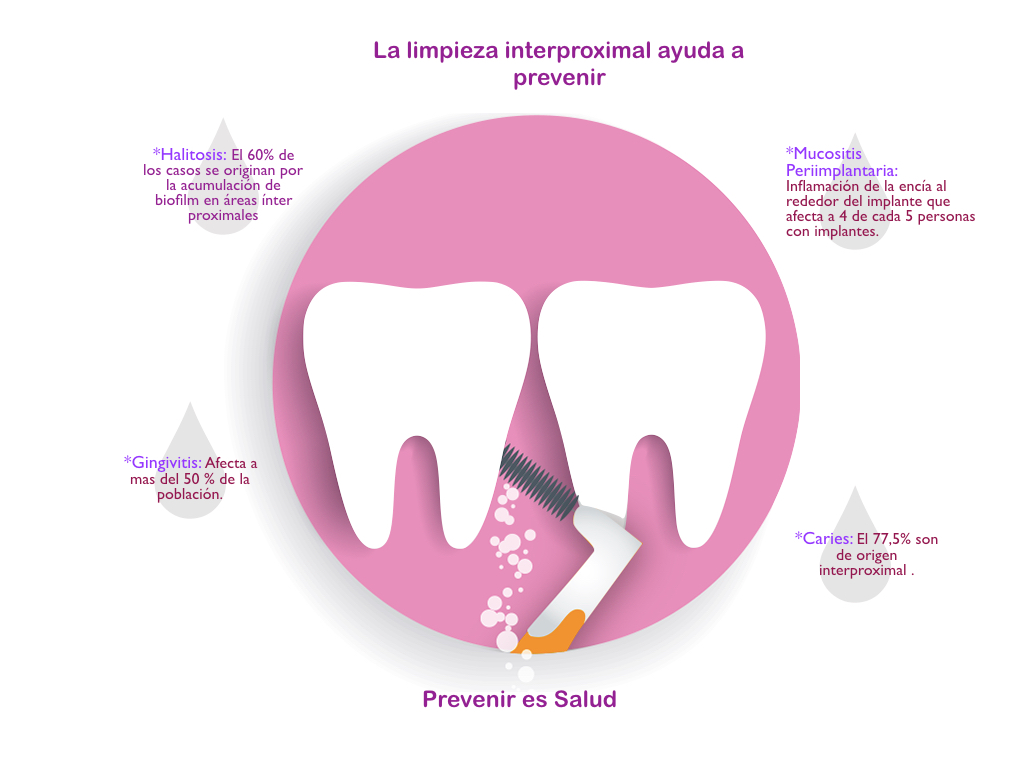 Higiene Interproximal · Dentclinic · Mataró
