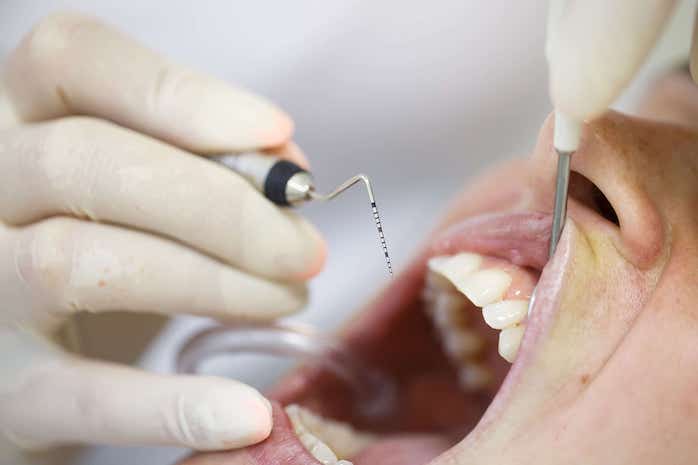 gingivitis- periodontitis-inflamacion de las encías- mal aliento