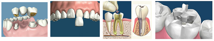 Rehabilitación Oral · DentClínic · Clínica Dental Mataró