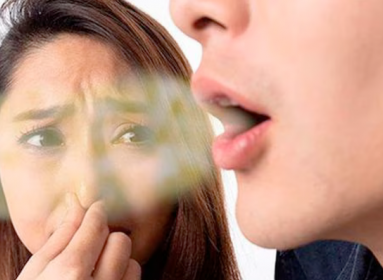 Halitosis: Descubre Causas y Soluciones para un Aliento Fresco