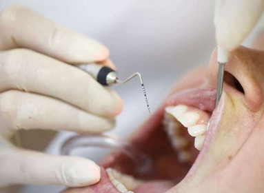 Enfermedad Periodontal: Una Amenaza silenciosa para tu salud bucal